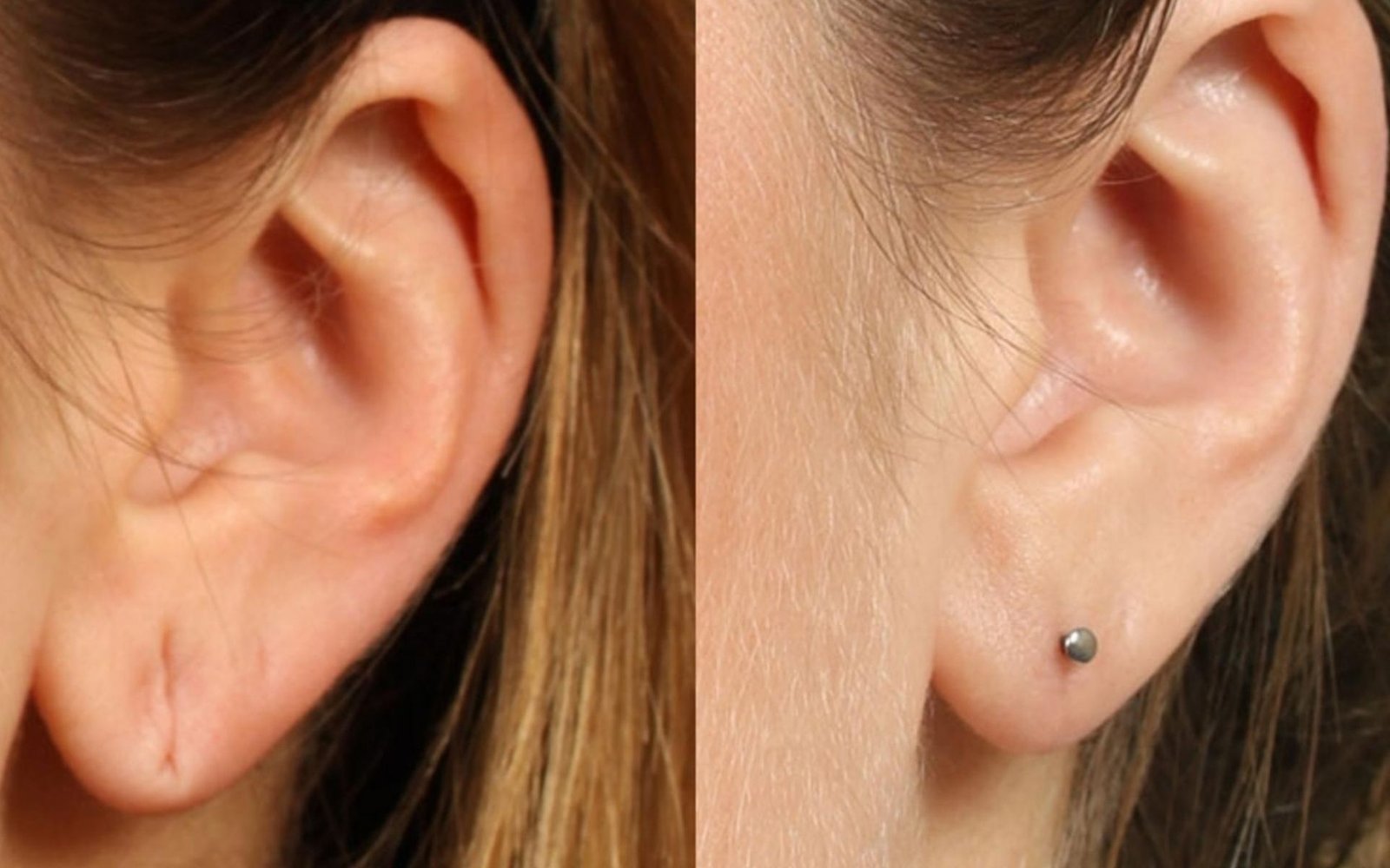 Ear Loop Correction